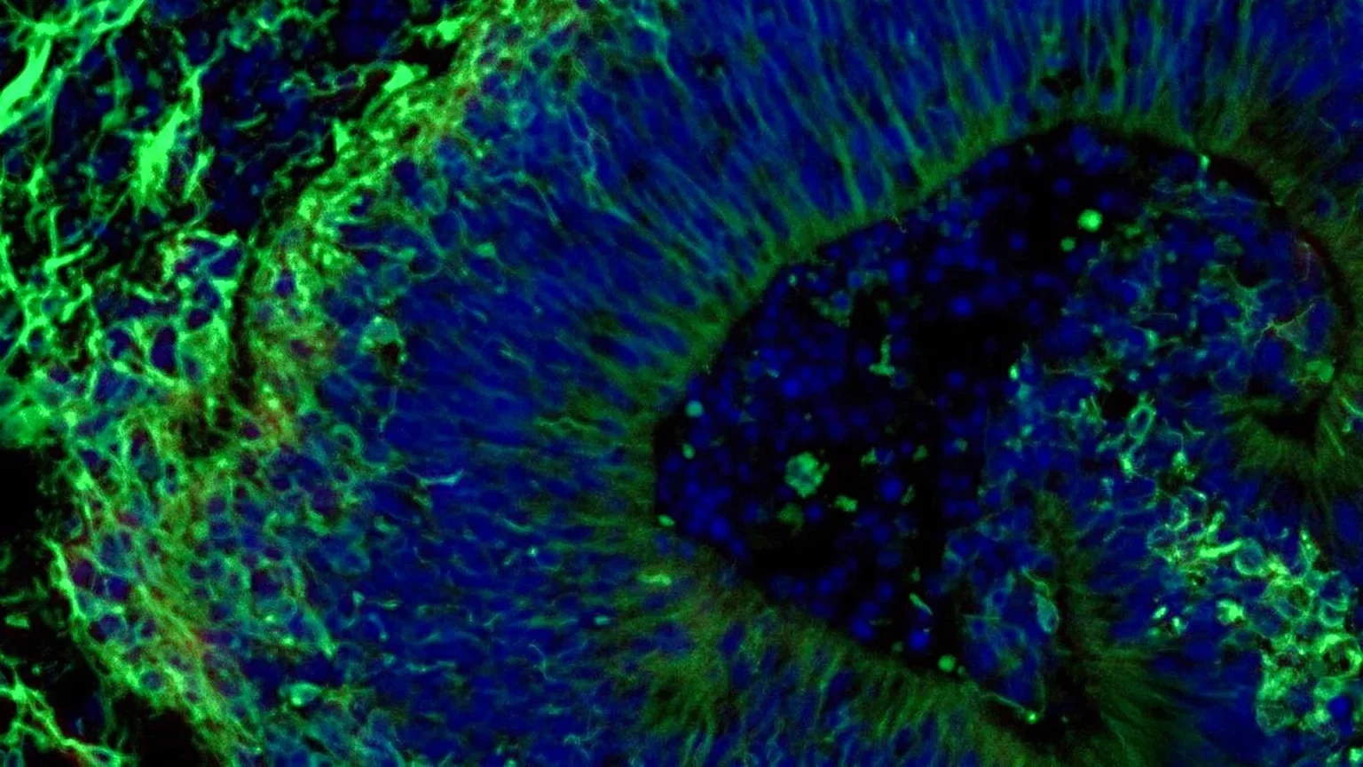 Lab-grown mini-brains could predict which Alzheimer’s treatments will work Lab-grown mini-brains could predict which Alzheimer’s treatments will work