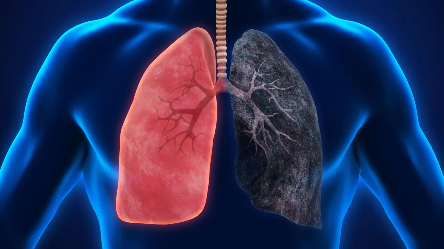 Researchers warn that heavy marijuana smoking may increase cancer risk
