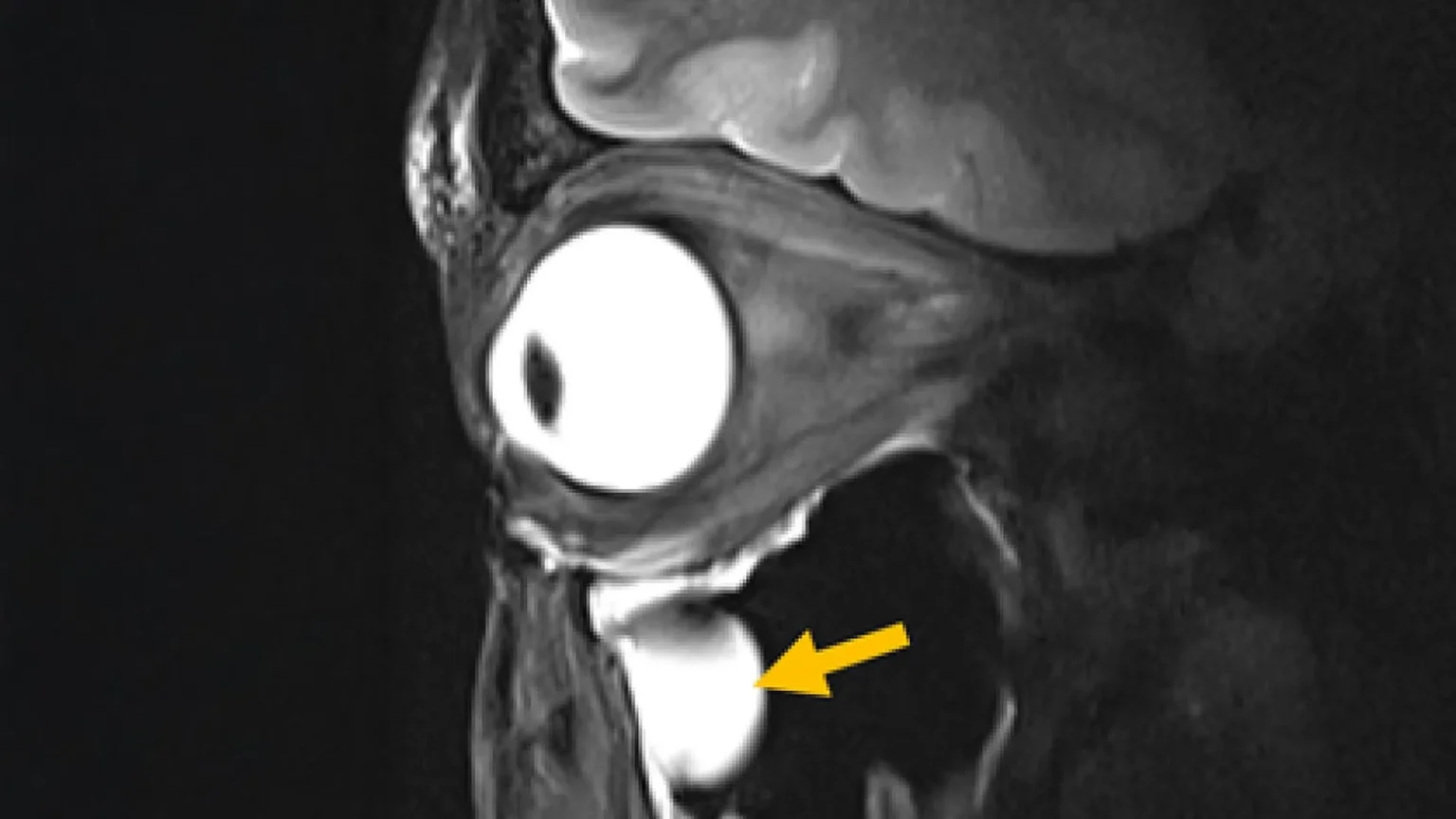 New MRI breakthrough reveals more about the brain and eyes than ever before New MRI breakthrough reveals more about the brain and eyes than ever before