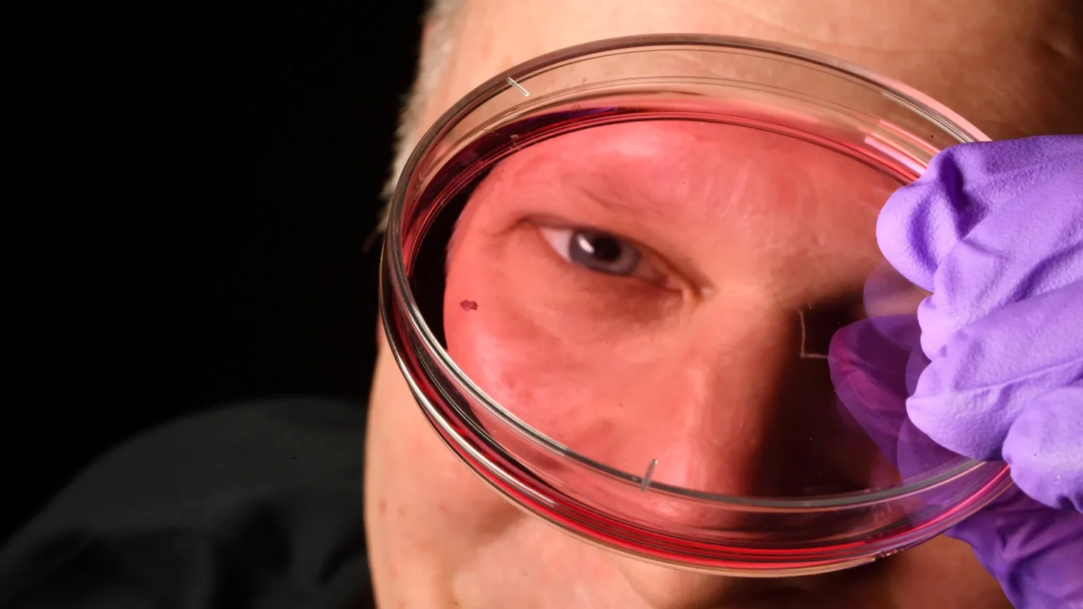 Discovery of vitamin A is changing what scientists know about vision